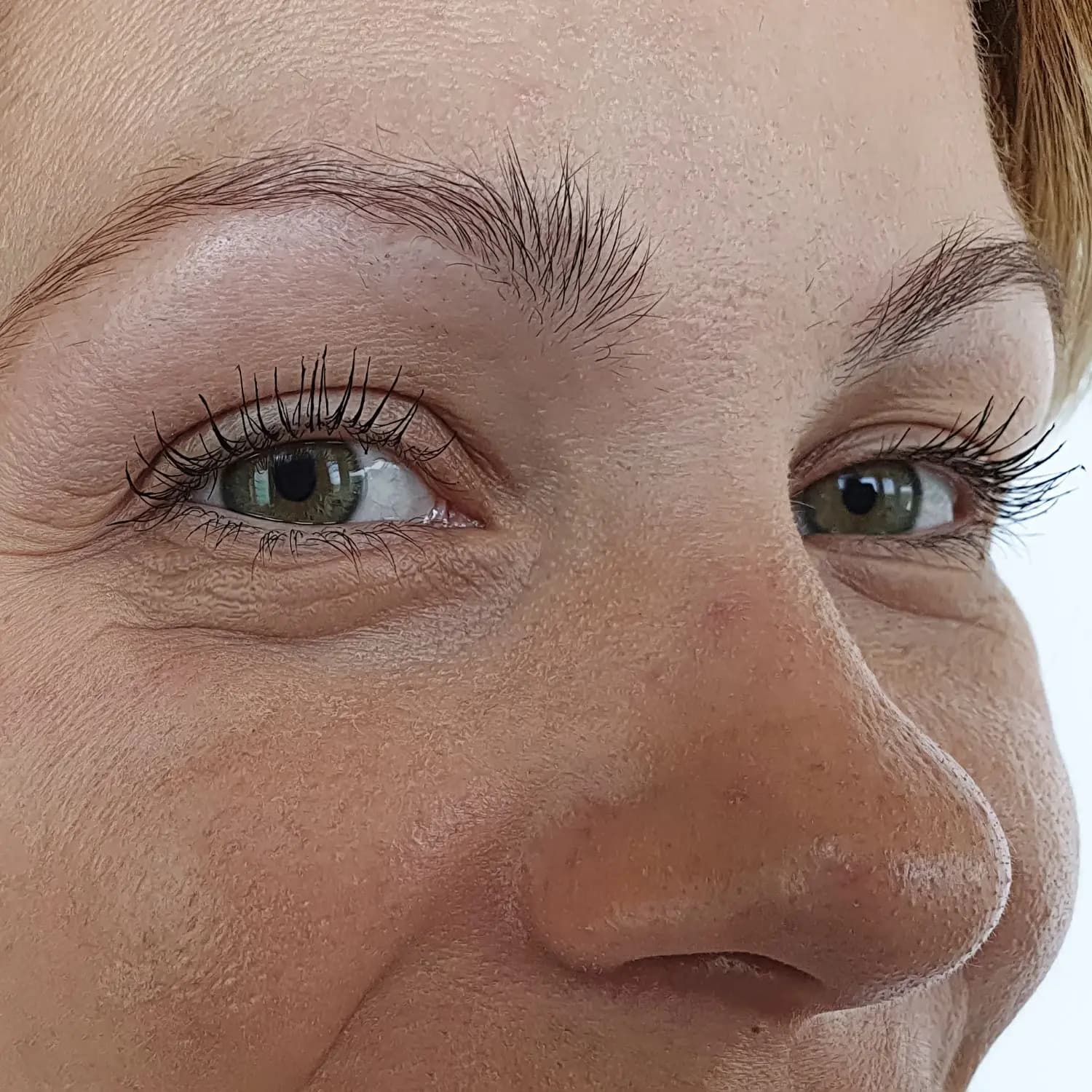 Tebrima after