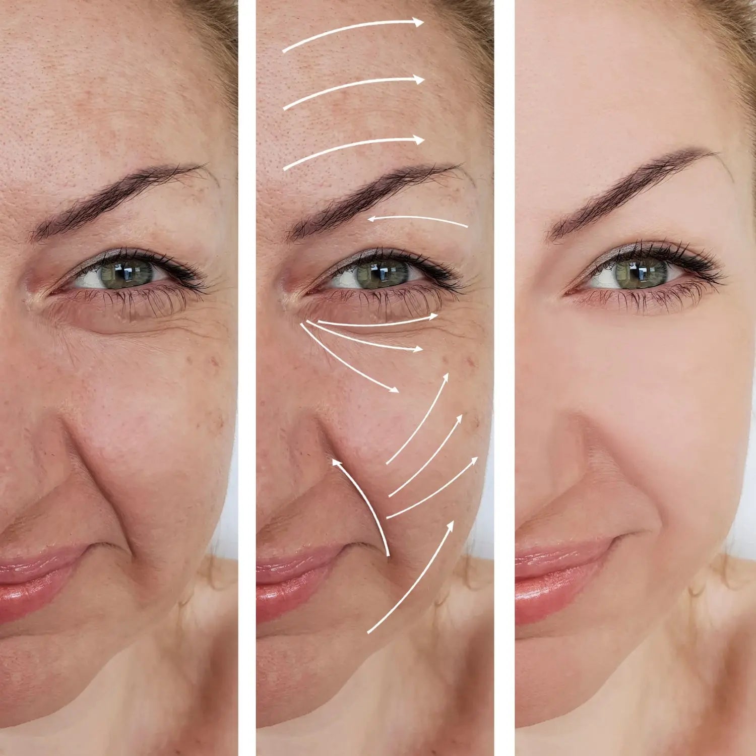 Natural Skincare Routine for Oily Skin