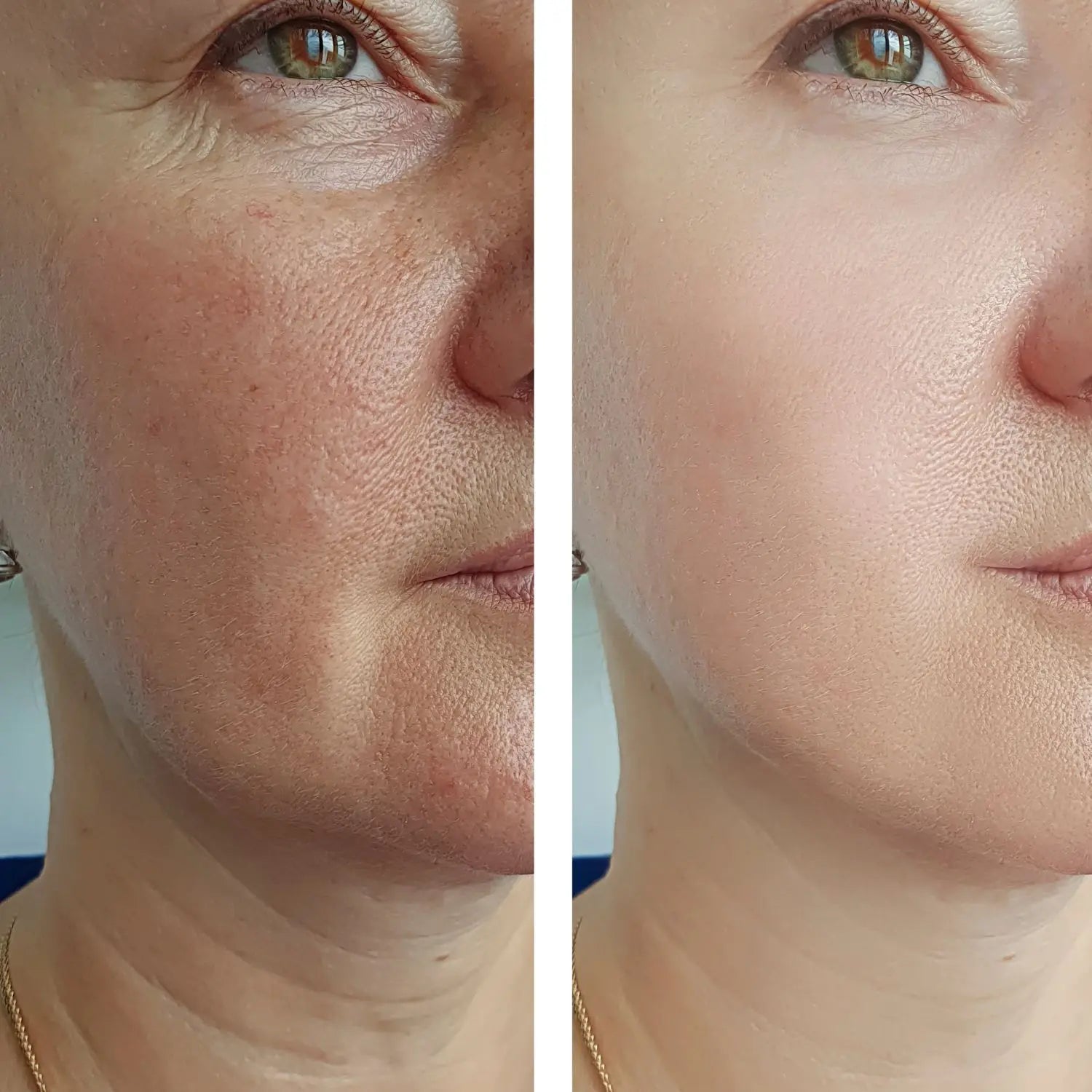 glowing skin natural skincare