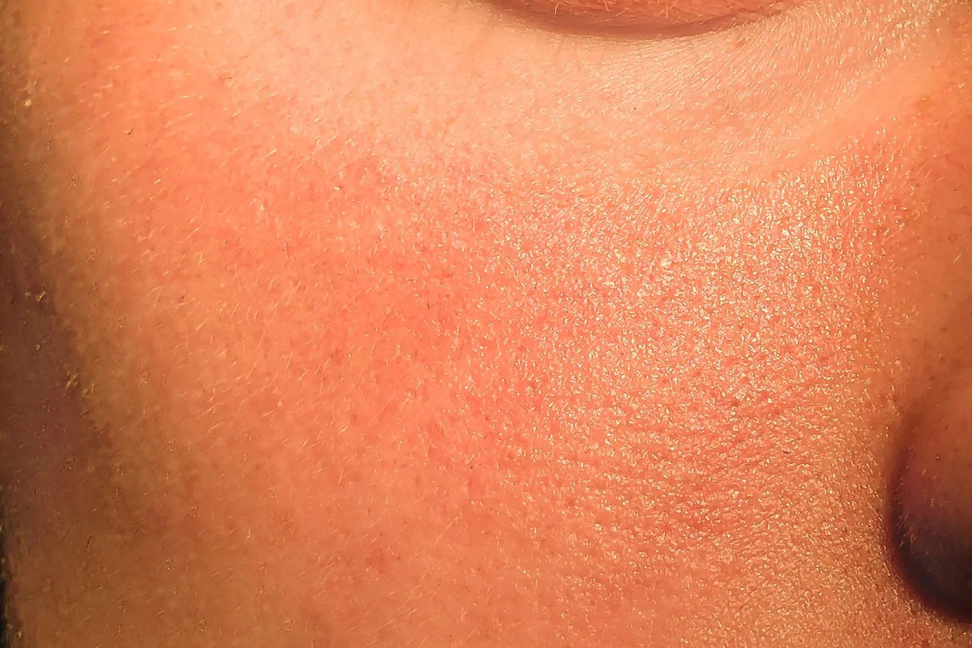 How to reduce the appearance of pores? - Oasiac