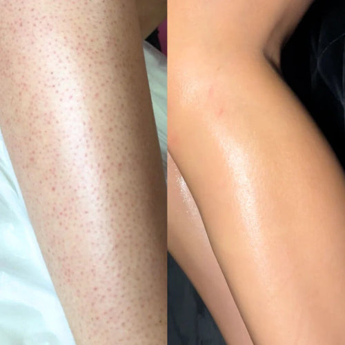 Argan Oil for Face Overnight: Benefits and How to Use It