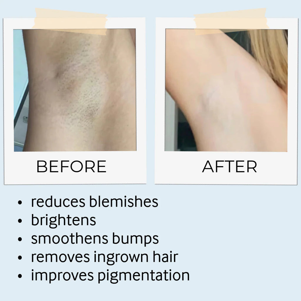 before and after skine care results