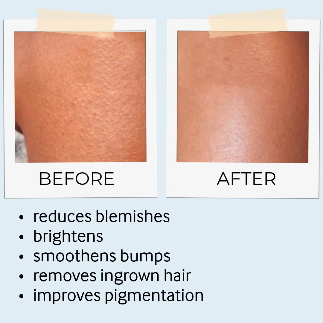 before and after skine care results 1