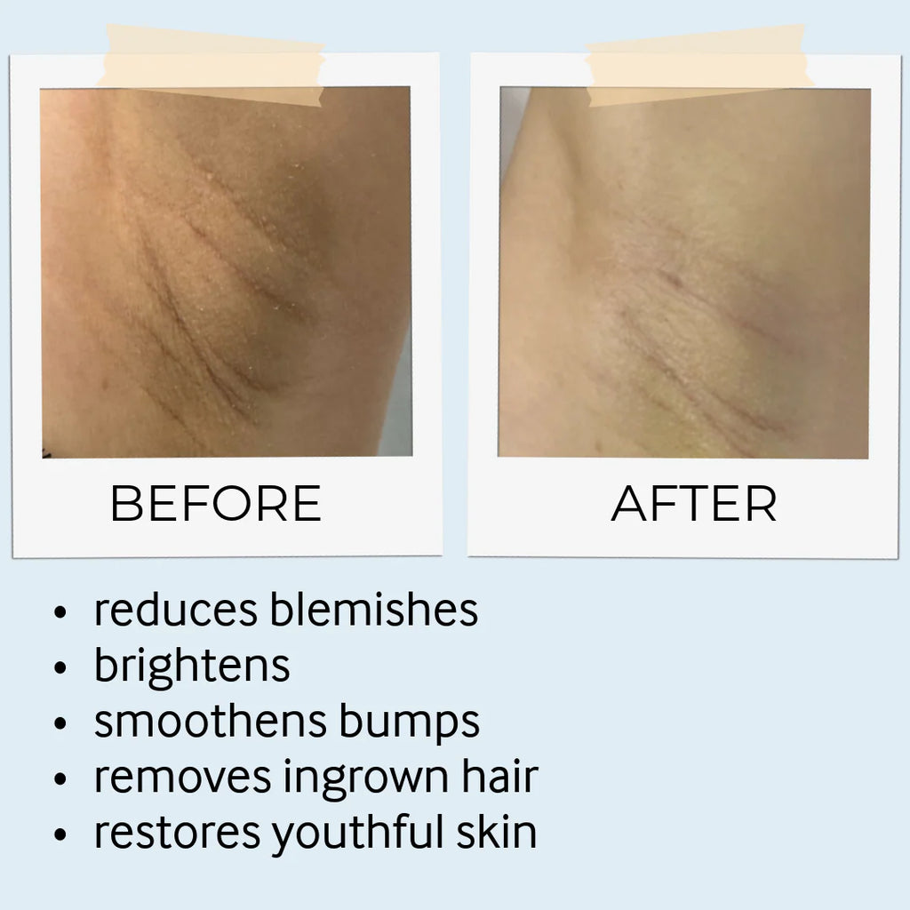 before and after skine care results 2