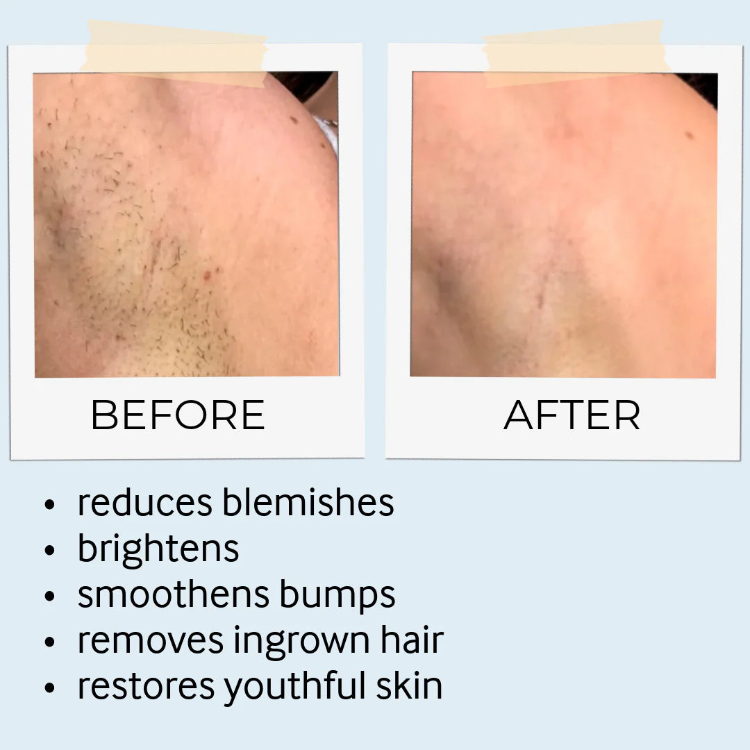 before and after skine care results 3
