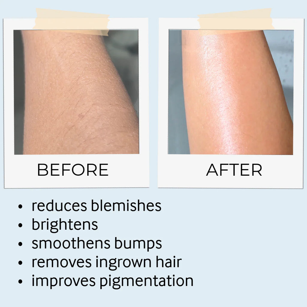 before and after skine care results 4