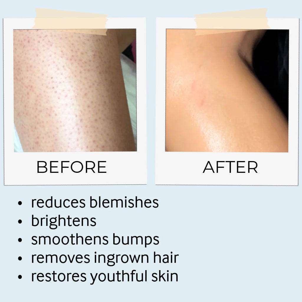 before and after skine care results 5