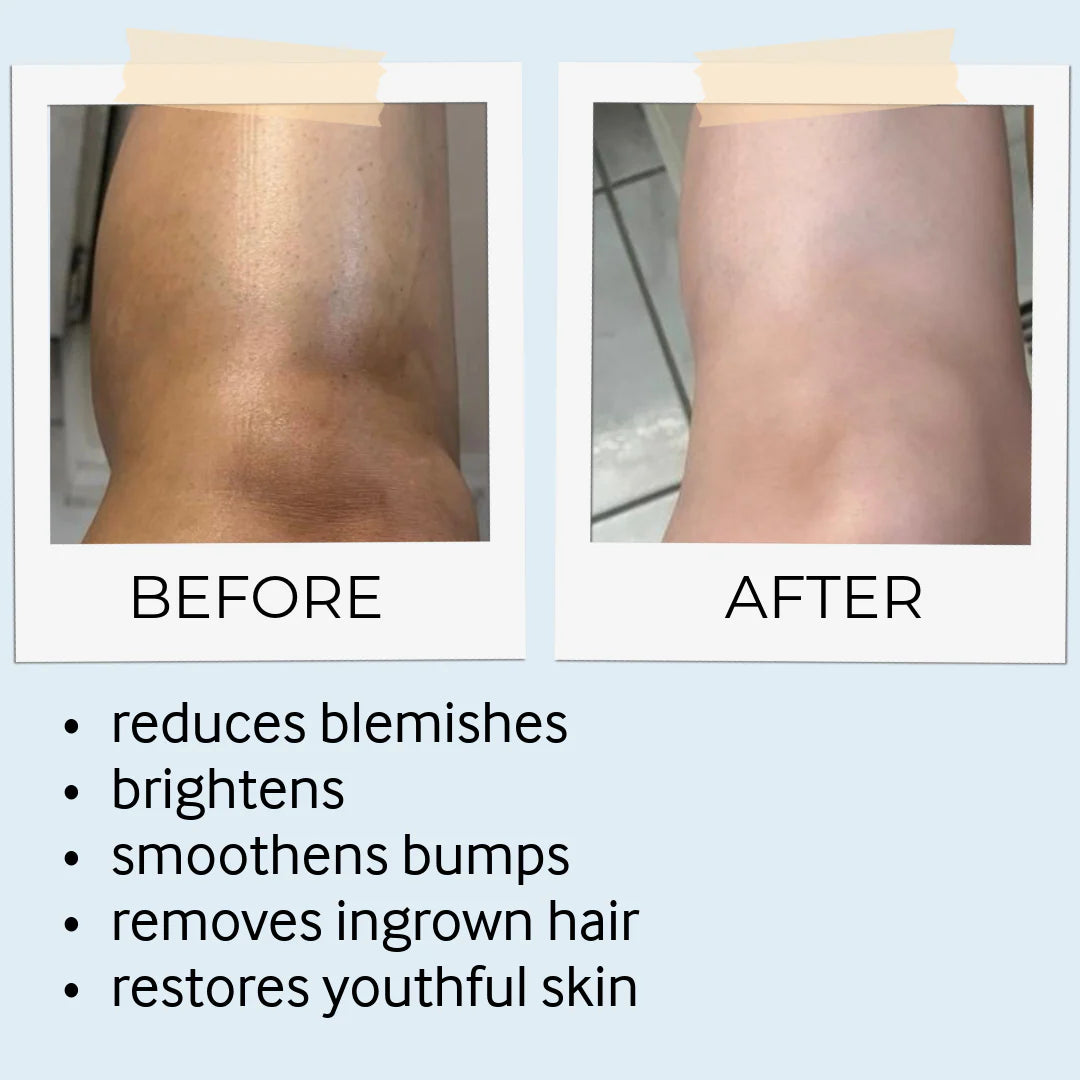 before and after skine care results 6