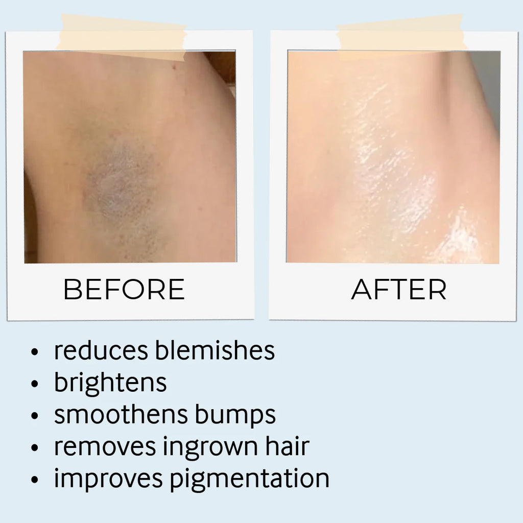 before and after skine care results 7