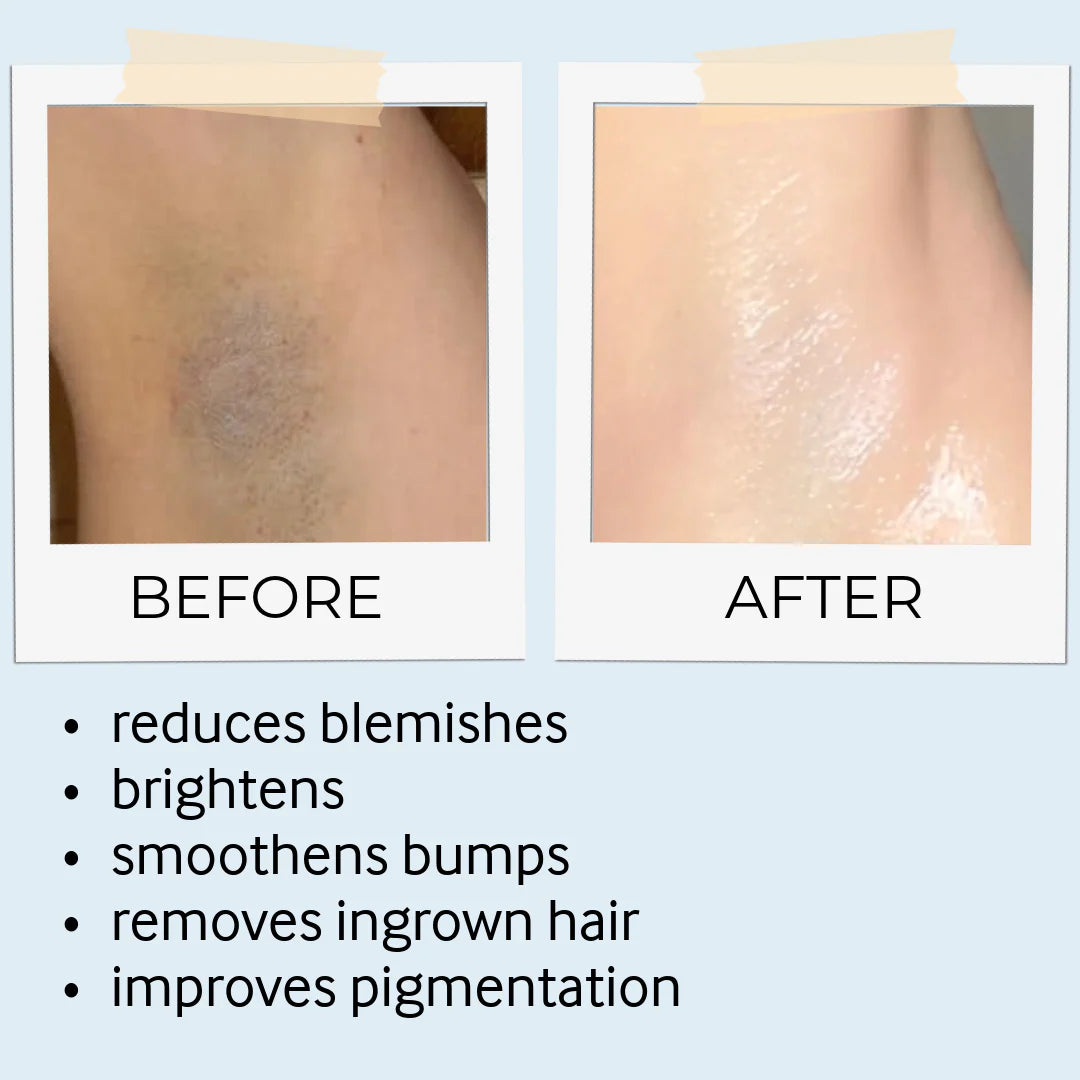before and after skine care results 7