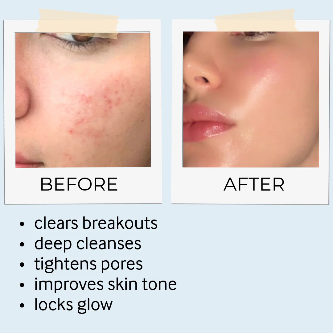 Rhassoul Mask & Scrub