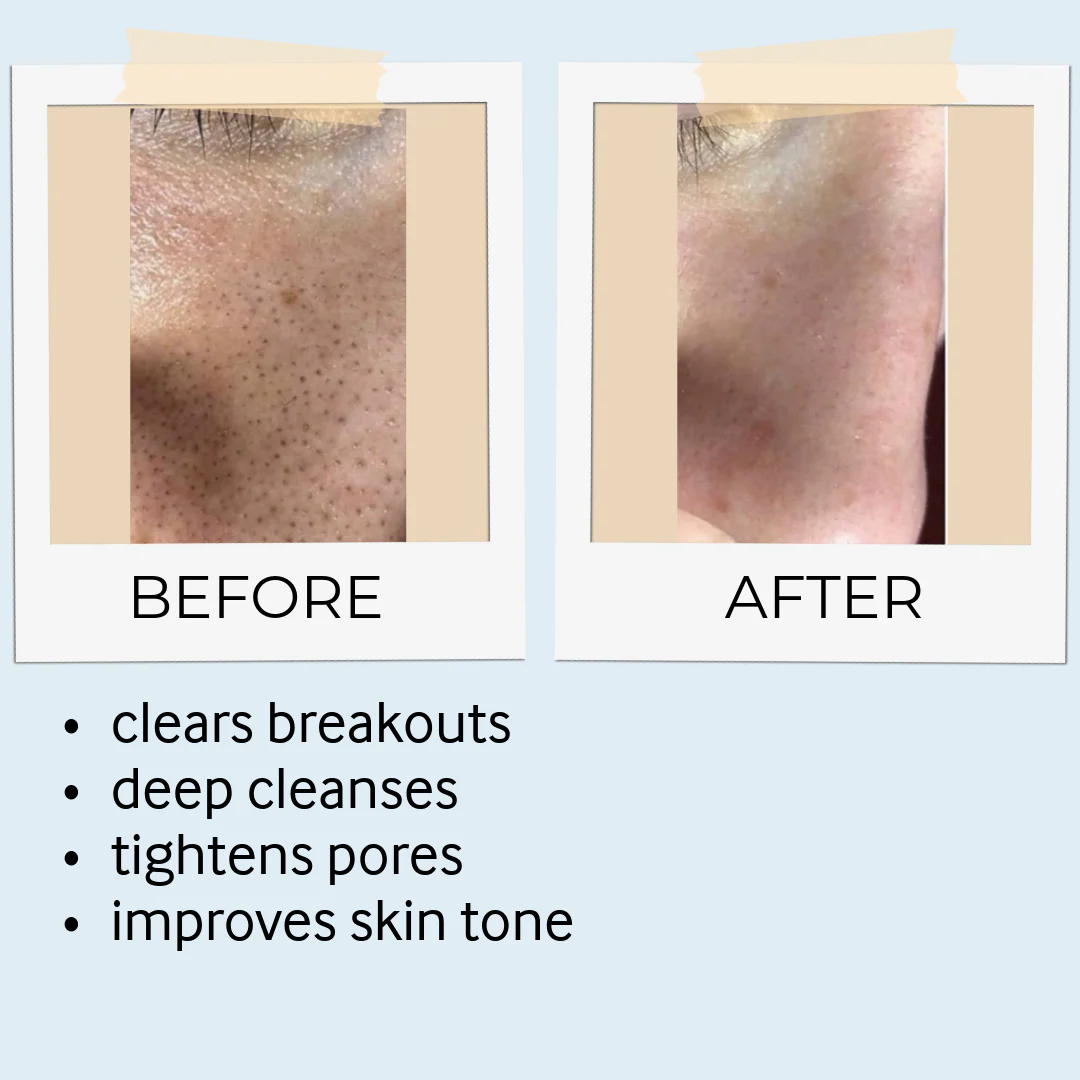 Rhassoul Mask & Scrub