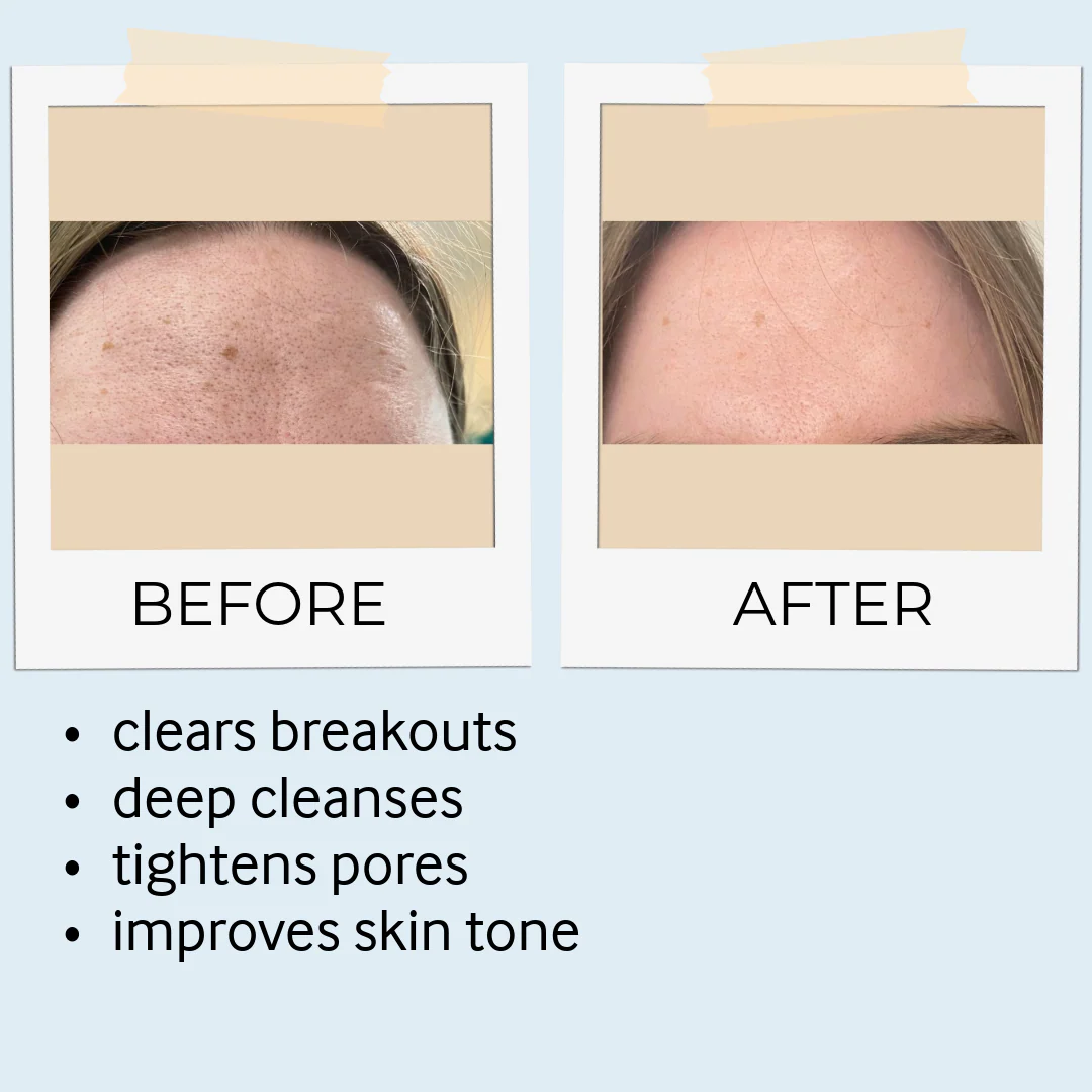 Rhassoul Mask & Scrub