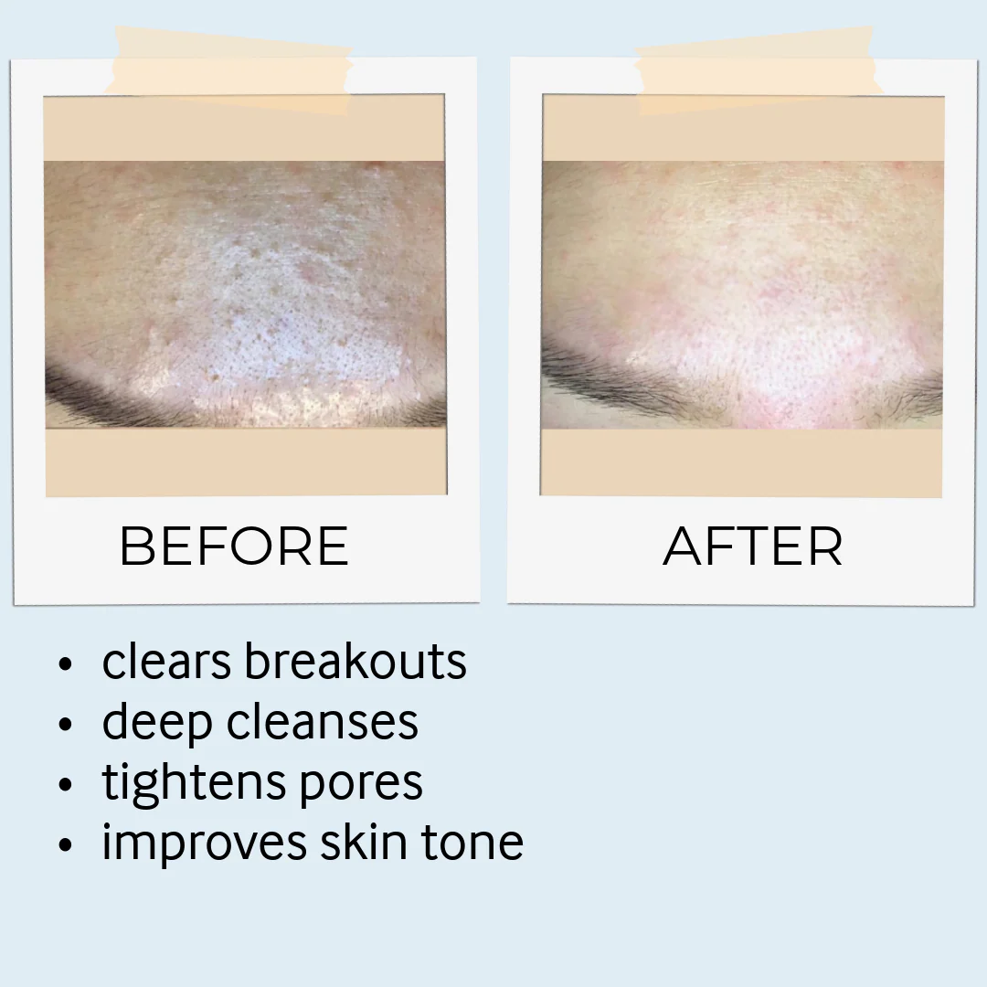 Rhassoul Mask & Scrub
