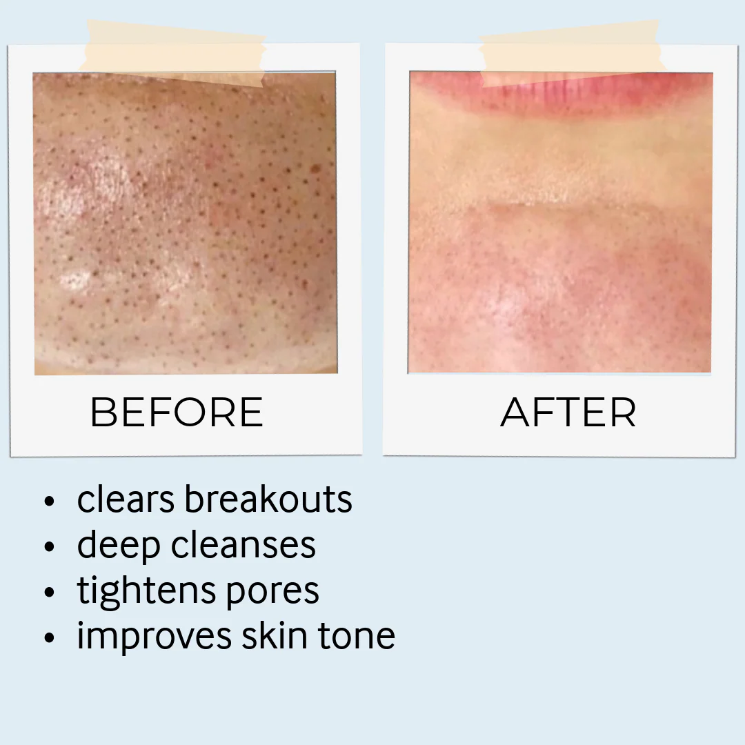 Rhassoul Mask & Scrub