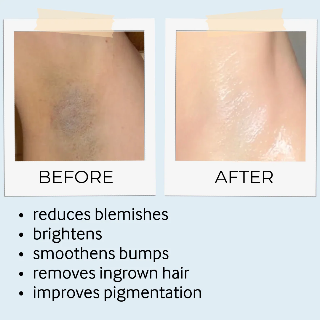 Tebrima Body Mask